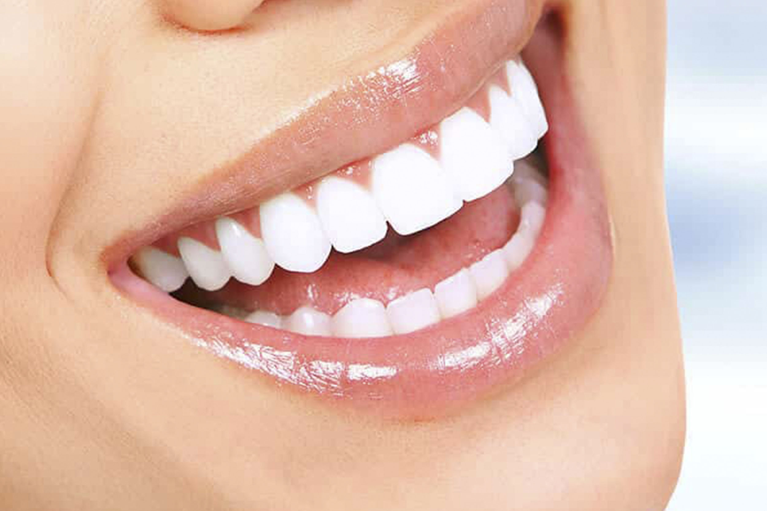 https://frigyadental.com/wp-content/uploads/2023/03/emax.jpg