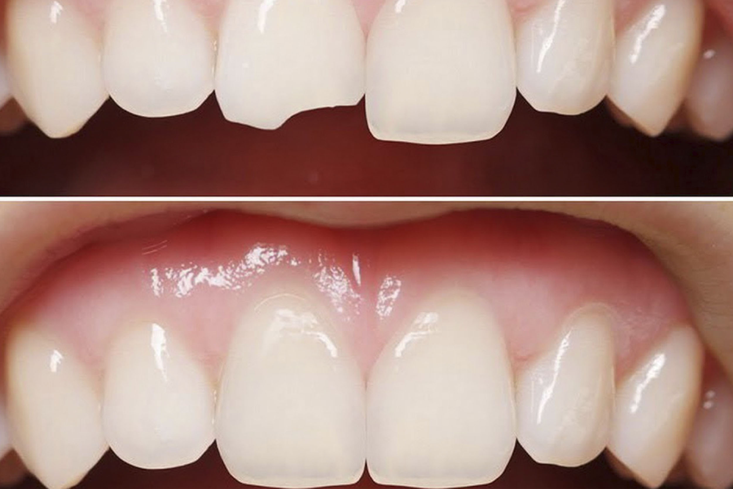 https://frigyadental.com/wp-content/uploads/2023/03/estetik.jpg